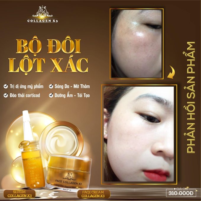 Review Kem Chống Nắng Nọc Ong Collagen X3 Đông Anh SPF 50G | Hàng Chuẩn Chính Hãng