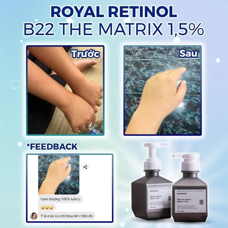 Review Kem Dưỡng Trắng Body Royal Retinol B22 The Matrix Retinol 1.5