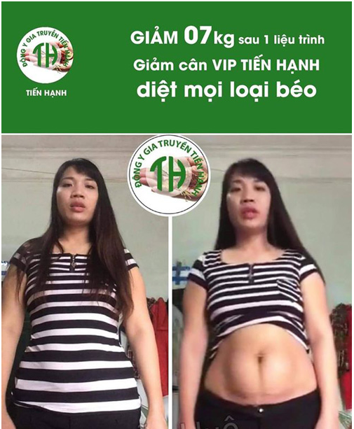 Review Viên Uống Giảm Cân Vip X2 Tiến Hạnh | Hỗ Trợ Giảm Béo, Giảm Mỡ 3-10Kg | Hàng Chính Hãng