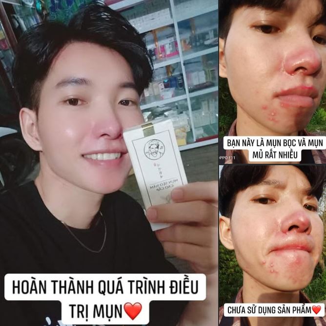 Hướng dẫn sử dụng